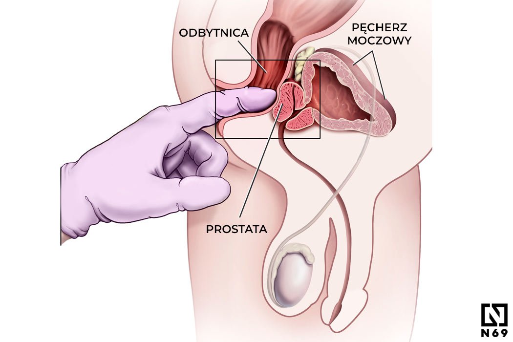 masaż prostaty podczas erekcji